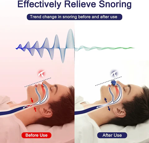 Mikro CPAP Anti-Snorkenhed | Maskeløs Søvnapnabehandling
