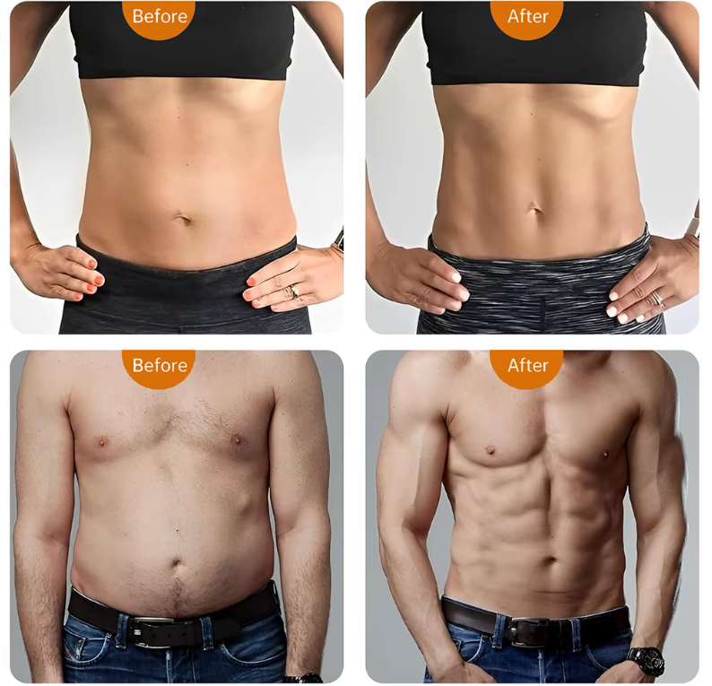 Abdominal Toning Bælte Med Ti Tilstande Og Tredive Intensitetsniveauer