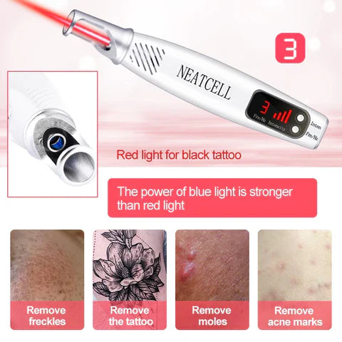 LumiDerm Hjemme Laser Pen til Fjernelse af Tatoveringer, Modermærker og Frækler