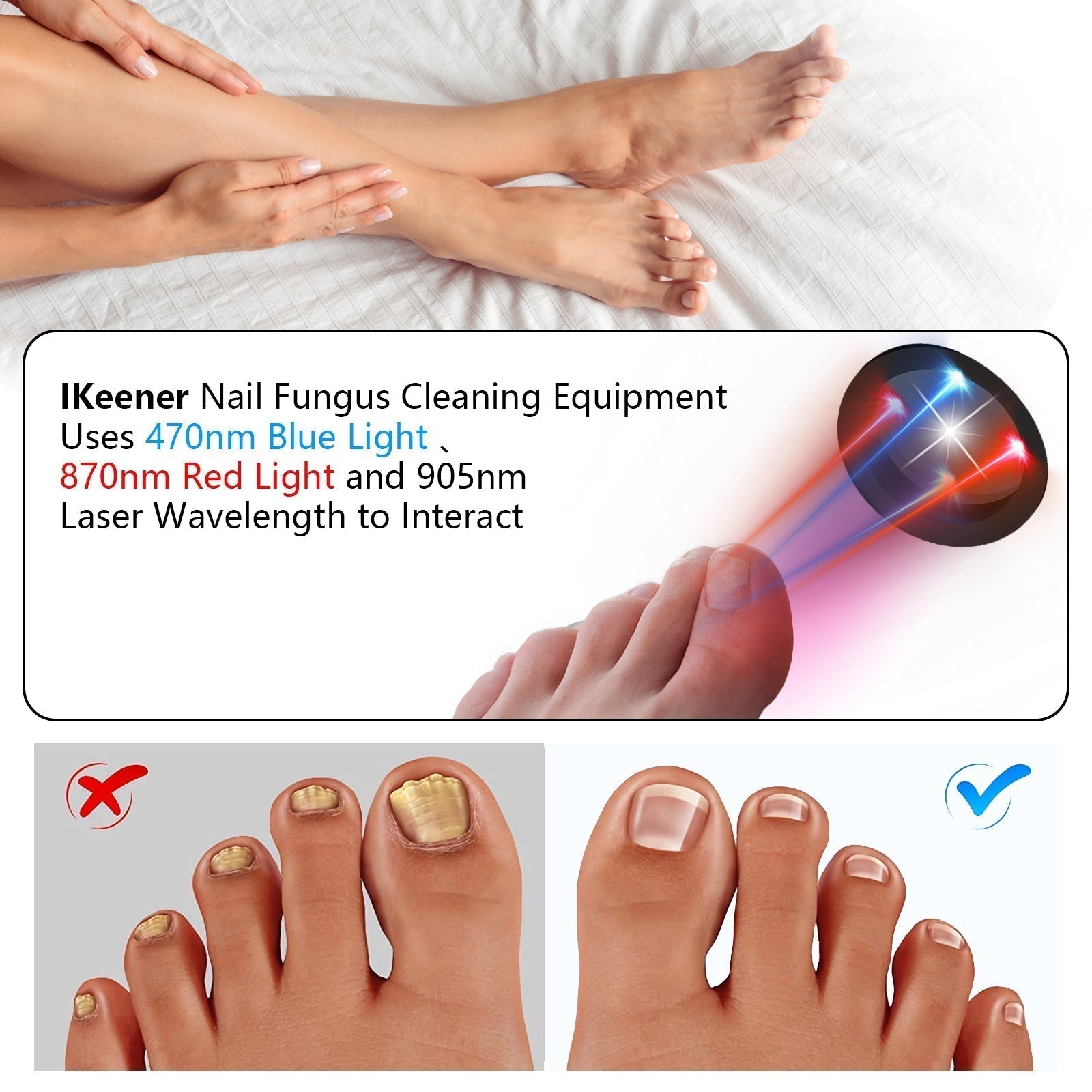 ApexNova Laser Neglesystem Til Nem Hjemmebrug Og DIY Pleje