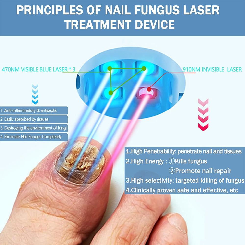 NexaLume Hjemme Laser Neglepleje Enhed Nem At Bruge
