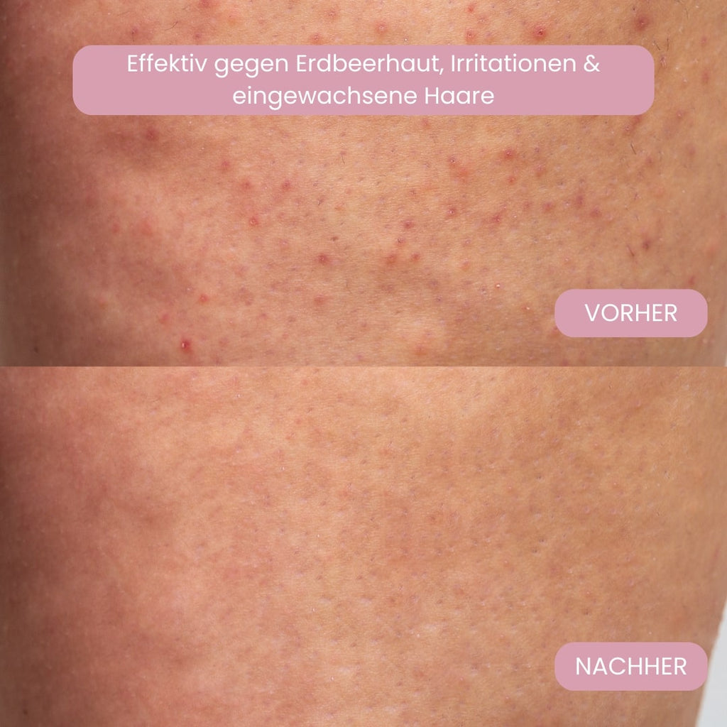 Intimbarbermaskine til kvinder | Elektrisk damebarbermaskine til intimområdet | Bikini Trimmer | Femora