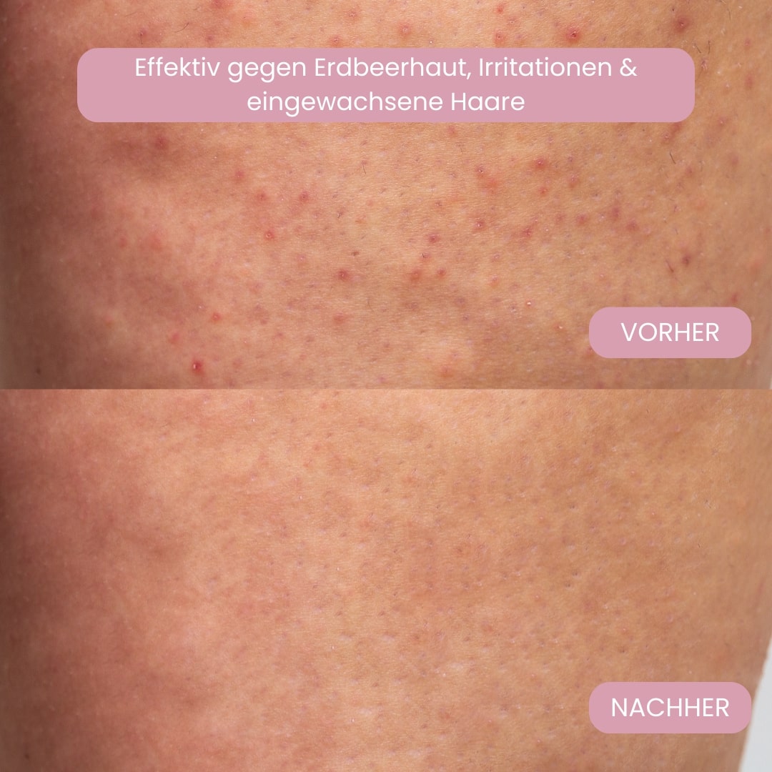 Intimbarbermaskine til kvinder | Elektrisk damebarbermaskine til intimområdet | Bikini Trimmer | Femora
