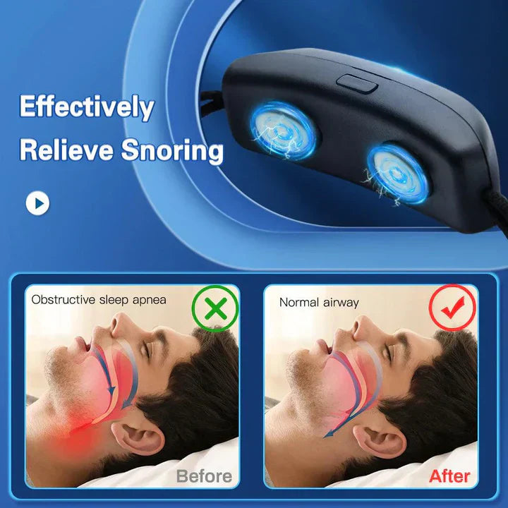Smart Anti-Snorke Enhed EMS Pulse Stop Snorke Bærbar Behagelig Søvn Stop Snorke Sundhedspleje Søvnapnø Hjælp USB